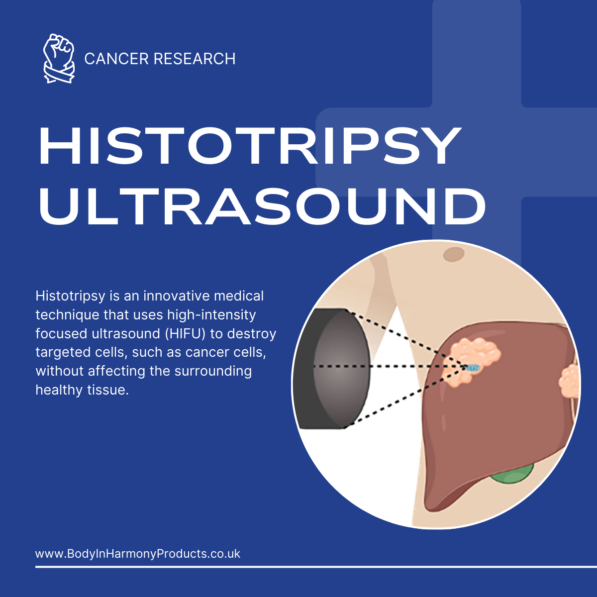 Cure Cancer with Histotripsy – 85-95% Success Rate