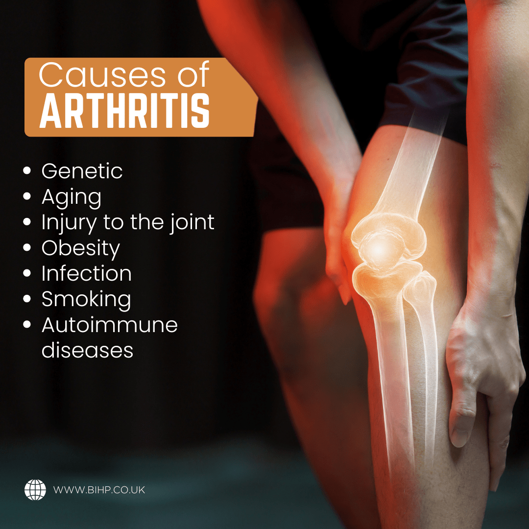 Is Arthritis Genetic? What Your DNA Might Reveal