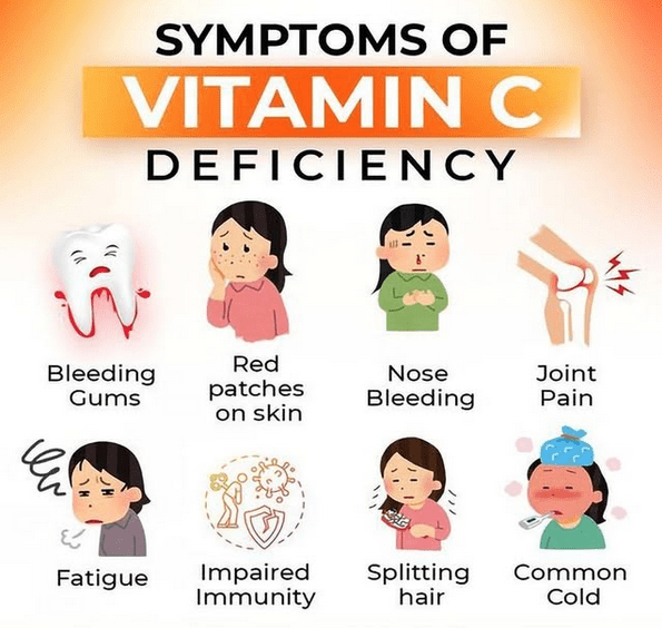 Vitamin C Deficiency: Signs, Causes, and Prevention